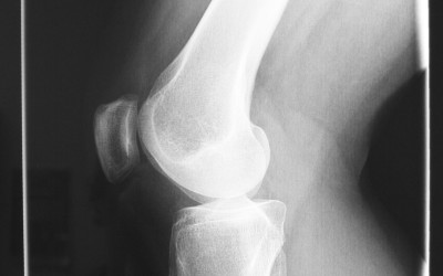 Rehabilitacja to dziedzina medycyny, która ogromnie błyskawicznie się ewoluuje